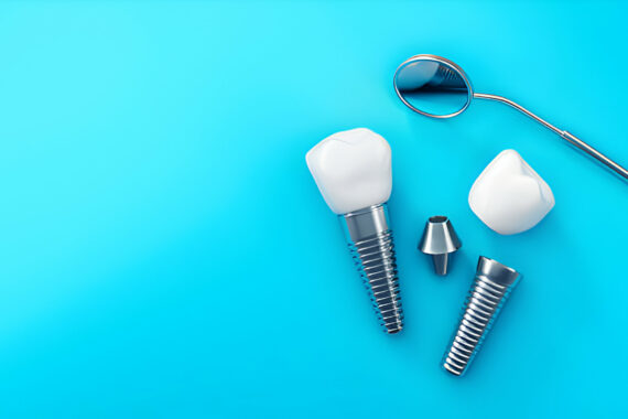 Everything You Need to Know About Dental Implants: Types, Procedures, Uses_FI