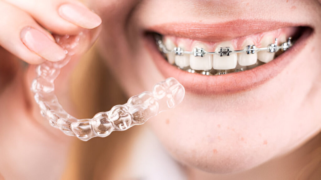 How to Choose the Right Orthodontist: A Comprehensive Guide_2