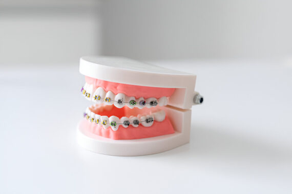 How to Choose the Right Orthodontist: A Comprehensive Guide_FI